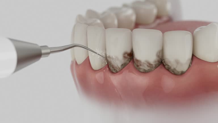 Reliable Dental contractor in Bothell East, WA by Dentist Open Now